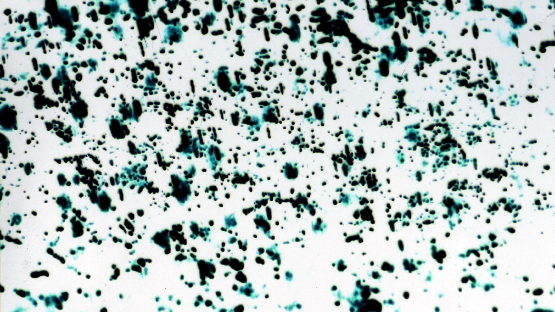 2022-01-03 John Cage - Complete Song Books (KR029) (2016) (2V) (Mix und Remix)
