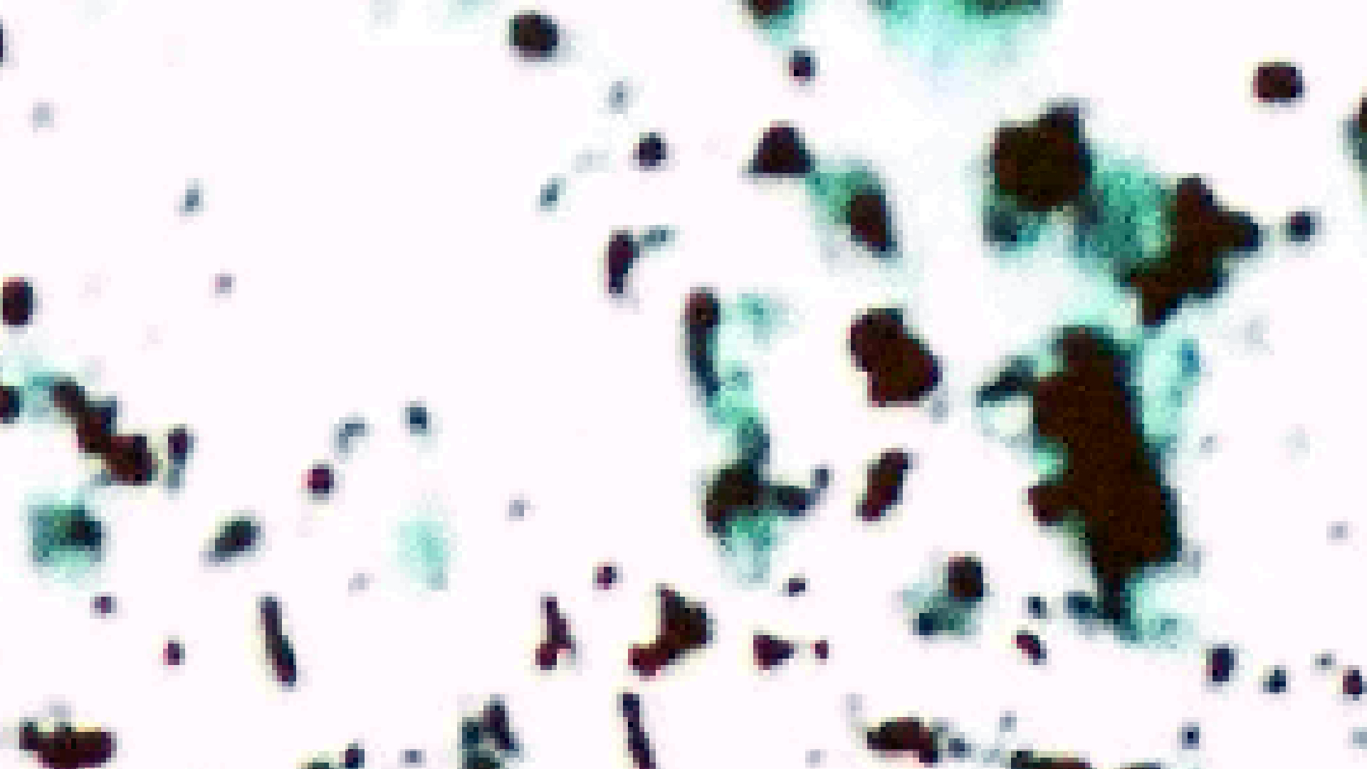 2022-01-03 John Cage - Complete Song Books (KR029) (2016) (2V) (Mix und Remix)